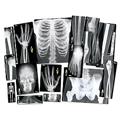 Развивающий набор Рентгеновские снимки (18 шт) от Lakeshore